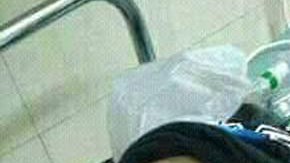 El menor murió, aproximadamente, 12 horas después de la mordida.