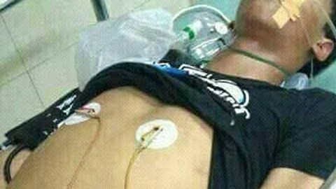El menor murió, aproximadamente, 12 horas después de la mordida.