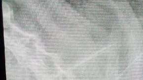 Radiografía del estómago de un perro que perdía peso sin que se supiera el motivo.