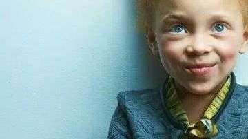 Generalmente, el color rojo no es percibido por las personas que padecen daltonismo.