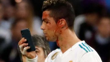 El delantero portugués del Real Madrid, Cristiano Ronaldo bañado en sangre. (Foto: EFE/ Juan Carlos Hidalgo)