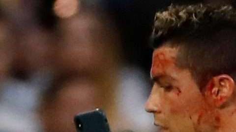 Cristiano Ronaldo bañado en sangre. EFE/ Juan Carlos Hidalgo