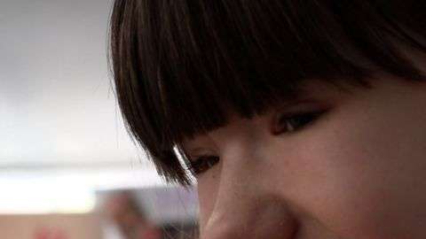 Holly quiere llamar la atención sobre la condición rara que afecta a sus ojos.