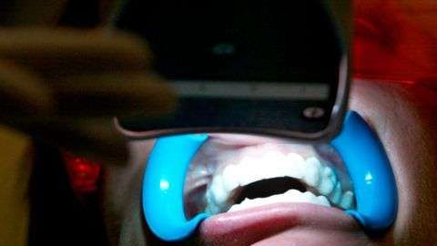 Cuando se usan de forma incorrecta los tratamientos de blanqueamiento pueden causar pérdida de dientes, quemaduras y ampollas.