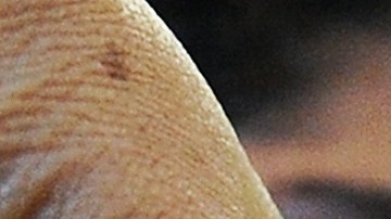 Los niños son principalmente vulnerables a la enfermedad.