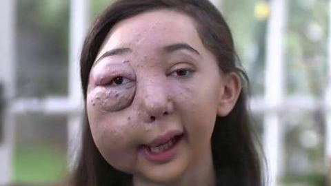 "He ido al hospital unas 600 veces", cuenta Nikki Christou.