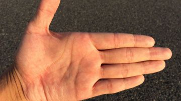 Los patrones de las venas pueden identificar la mano de un sospechoso.