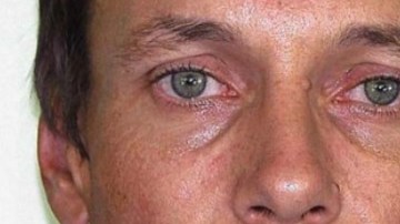 Brett Peter Cowan (en la foto) fue atacado con agua caliente.