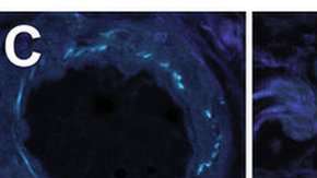 Las partes en azul oscuro son haces de colágeno fibrilar. En la imagen de la derecha se ven las fibras de elastina en negro y las estructuras de colágeno en rosa.