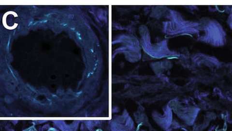Las partes en azul oscuro son haces de colágeno fibrilar. En la imagen de la derecha se ven las fibras de elastina en negro y las estructuras de colágeno en rosa.