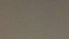 Para los médicos es sorprendente que Hawking haya sobrevivido más de 50 años con ELA.