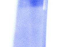 Luis Miguel La Serie se podrá ver en Telemundo y Netflix.