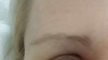 Narelle Krikhoff, de 53 años, descubrió que tenía cáncer y que no era una marcad e los lentes.