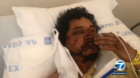 Sin seguro médico y sin ingresos, Reyes no sabe cómo va a mantener a su familia ahora. (Se ha establecido una cuenta GoFundMe para ayudarlo.)