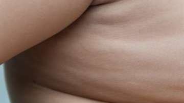 Cada día va en aumento la obesidad infantil.