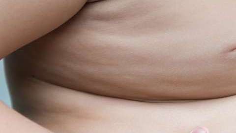 Cada día va en aumento la obesidad infantil.