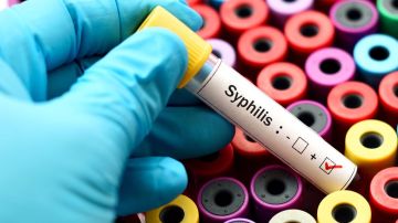 Cada año unos 5,6 millones de personas contraen sífilis en el mundo.
