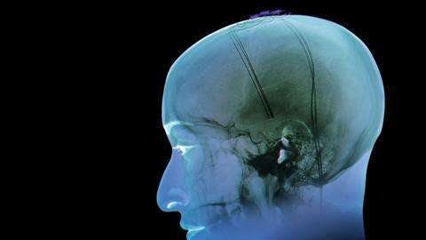 SCIENCE PHOTO LIBRARY