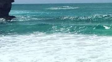 McWilliams sobrevivió el pasado jueves al ataque de un tiburón.