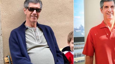 Kevin Daly, antes y después de la cirugía.
