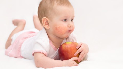 No se sabe qué causa que algunos niños tengan eccema, pero se sabe que puede tener un componente hereditario principalmente si uno de los padres sufre de asma o de alergias.