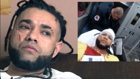 Merenguero Mala Fe también recibió heridas en la cara.