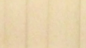 Un aumento de peso continuo dio paso a un diagnóstico de un tumor canceroso.