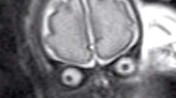 Radiografía muestra esta imagen del bebé.