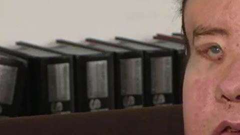 La operación tuvo lugar en enero y se prolongó por 16 horas.