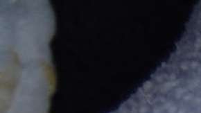 El sarampión es una enfermedad contagiosa.