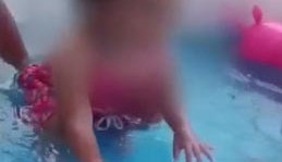 La bebé presenta quemaduras en un 10 % de su cuerpo.