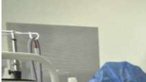 Por fortuna, el tumor resultó bengino.