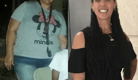 Yarelis Lebron antes y después de cambiar su estilo de vida.