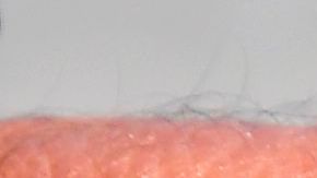 Insecto que trasmite el Zika