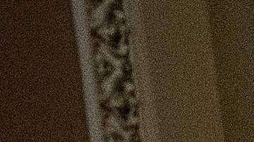 Tras una cirugía, el senador McCain había seguido su labor en el Senado.