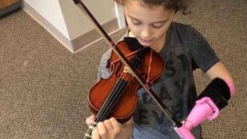 Esta niña por fin puede tocar el violín gracias al invento de un prótesis que se lo permite.