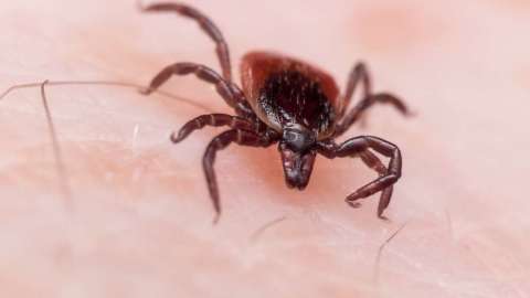 Descubre cuáles son su síntomas y cómo puedes prevenir dicha enfermedad.