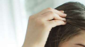 Genética, la principal razón.