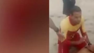 La playa es conocida por los ataques de tiburones a bañistas.