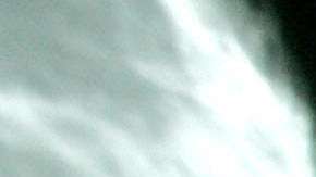 La terapia experimental promete resultados para combatir el cáncer de mama.