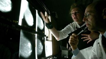 La terapia experimental promete resultados para combatir el cáncer de mama.