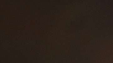 La actriz se ha sometido a un sinfín de tratamientos estéticos con resultados fallidos.