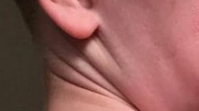 Oscar Martin sufrió quemaduras de primer grado