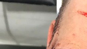 José Manuel Figueroa se accidenta