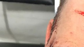 José Manuel Figueroa se accidenta