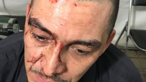 José Manuel Figueroa se accidenta