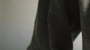 La adenomiosis provoca fuerte dolor pélvico y sangrado abundante.