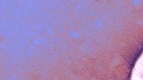 La FDA acaba de aprobar un medicamento para combatir la viruela.