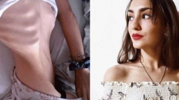 Impactante: el antes y el después de Camila.