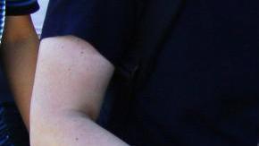 El herido dejó manchas de sangre en la acera de la embajada